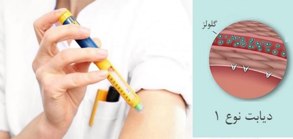 ديابت وابسته به انسولين